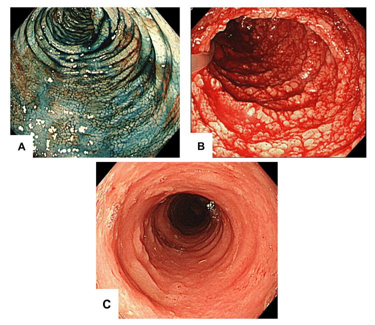 https://cdn.ncbi.nlm.nih.gov/pmc/blobs/7b76/10336742/c13ef2b0fc03/cureus-0015-00000040286-i02.jpg