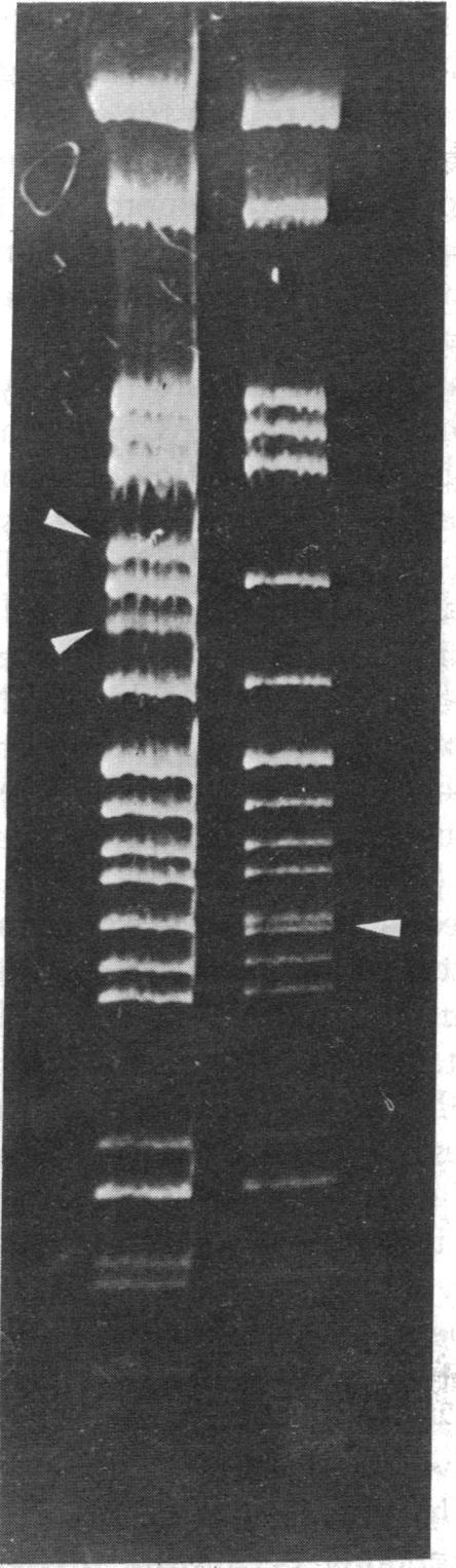 https://cdn.ncbi.nlm.nih.gov/pmc/blobs/7b7e/430960/2c1a3deb72cb/pnas00039-0211-a.jpg