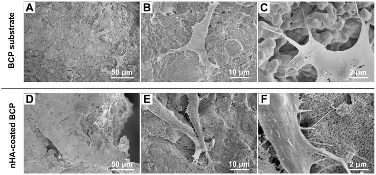 https://cdn.ncbi.nlm.nih.gov/pmc/blobs/7b7e/6781424/eebb1b62a1bd/IJN-14-7987-g0003.jpg