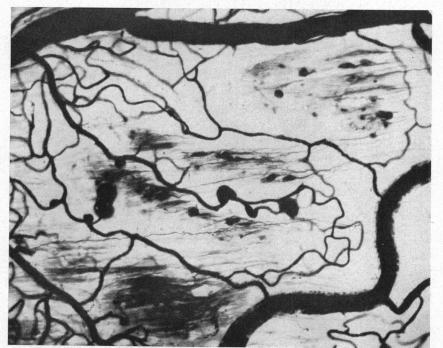 https://cdn.ncbi.nlm.nih.gov/pmc/blobs/7b81/505844/1e64216e8537/brjopthal00405-0023-b.jpg