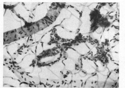 https://cdn.ncbi.nlm.nih.gov/pmc/blobs/7b81/505844/5b349cd02f27/brjopthal00405-0023-a.jpg