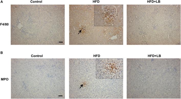 https://cdn.ncbi.nlm.nih.gov/pmc/blobs/7b81/7119336/47a3f0baa55f/fmed-07-00080-g0005.jpg