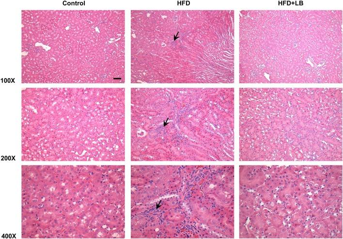 https://cdn.ncbi.nlm.nih.gov/pmc/blobs/7b81/7119336/da67226f87c9/fmed-07-00080-g0004.jpg