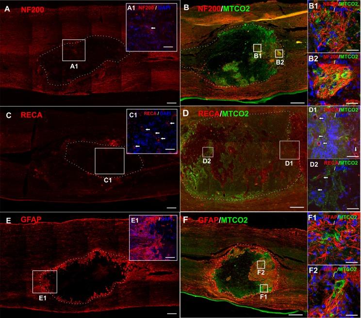 https://cdn.ncbi.nlm.nih.gov/pmc/blobs/7b83/6628561/e2d862cbce2f/10.1177_0963689718823705-fig5.jpg