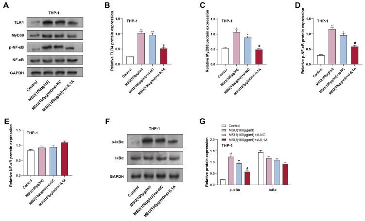 https://cdn.ncbi.nlm.nih.gov/pmc/blobs/7b87/12244086/50486fe1ffb4/ijmsv22p3070g005.jpg