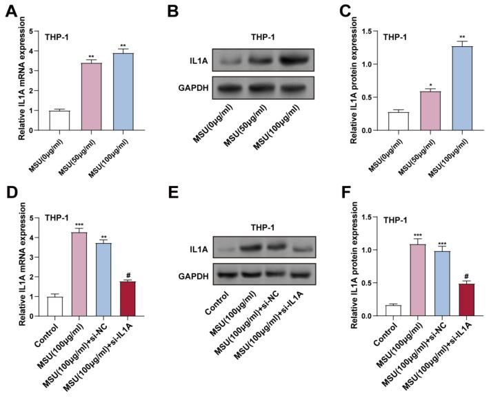 https://cdn.ncbi.nlm.nih.gov/pmc/blobs/7b87/12244086/af9af9e2f469/ijmsv22p3070g003.jpg