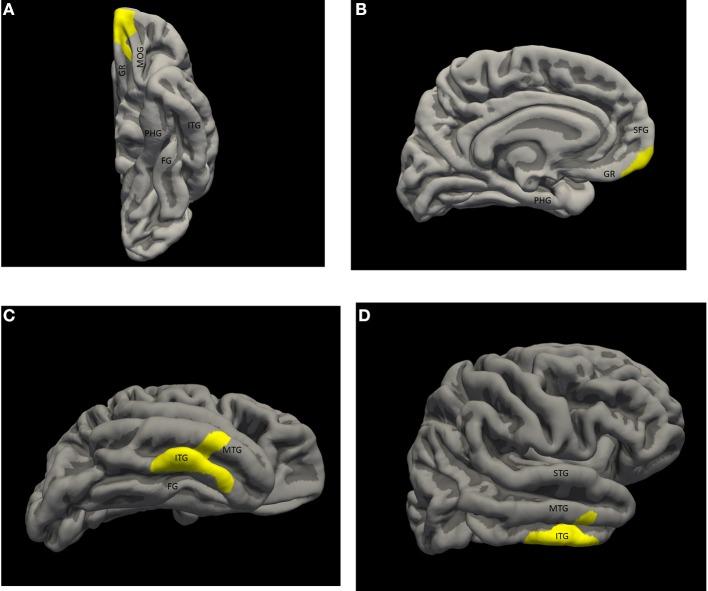 https://cdn.ncbi.nlm.nih.gov/pmc/blobs/7b88/4202711/857e47d64aac/fnhum-08-00833-g0001.jpg