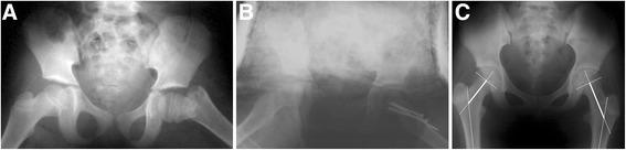 https://cdn.ncbi.nlm.nih.gov/pmc/blobs/7b90/4847264/721b97e3128d/13018_2016_387_Fig3_HTML.jpg