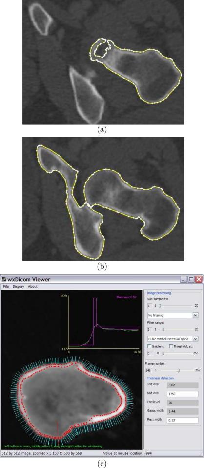 https://cdn.ncbi.nlm.nih.gov/pmc/blobs/7b9d/2868358/cd3371e0d11b/gr5.jpg