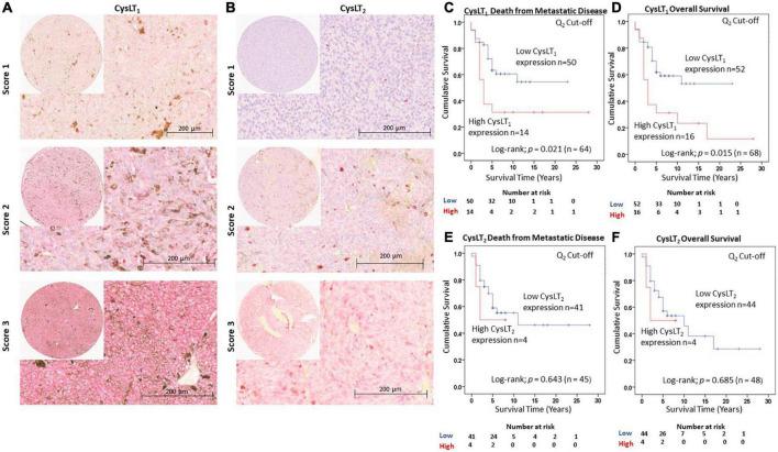 https://cdn.ncbi.nlm.nih.gov/pmc/blobs/7b9e/9868667/1c9a6613289f/fmed-09-1036322-g001.jpg