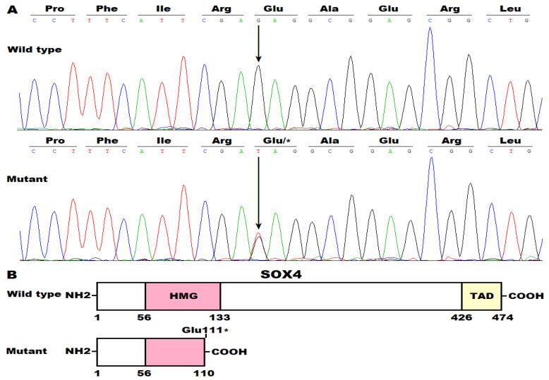 https://cdn.ncbi.nlm.nih.gov/pmc/blobs/7ba0/12109673/0f573139800e/children-12-00608-g002.jpg