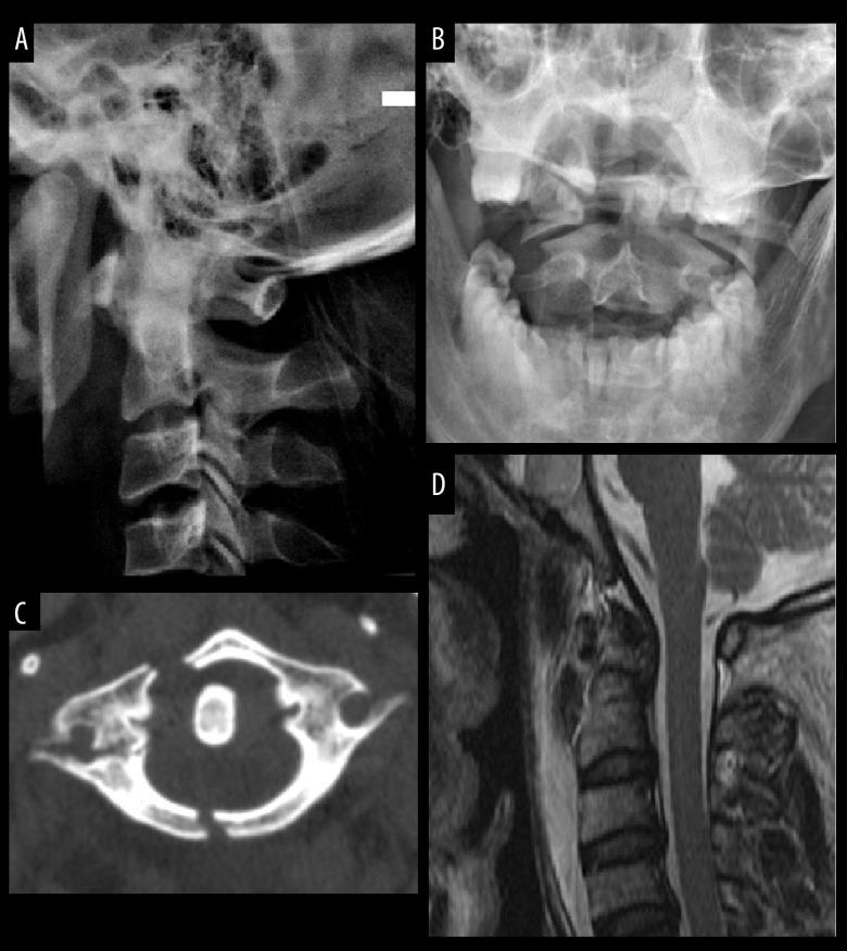 https://cdn.ncbi.nlm.nih.gov/pmc/blobs/7ba1/10201994/1d52af926fa5/medscimonit-29-e938600-g001.jpg