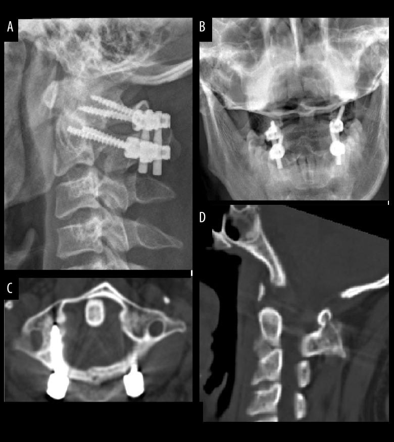 https://cdn.ncbi.nlm.nih.gov/pmc/blobs/7ba1/10201994/b5b95f36d91b/medscimonit-29-e938600-g003.jpg