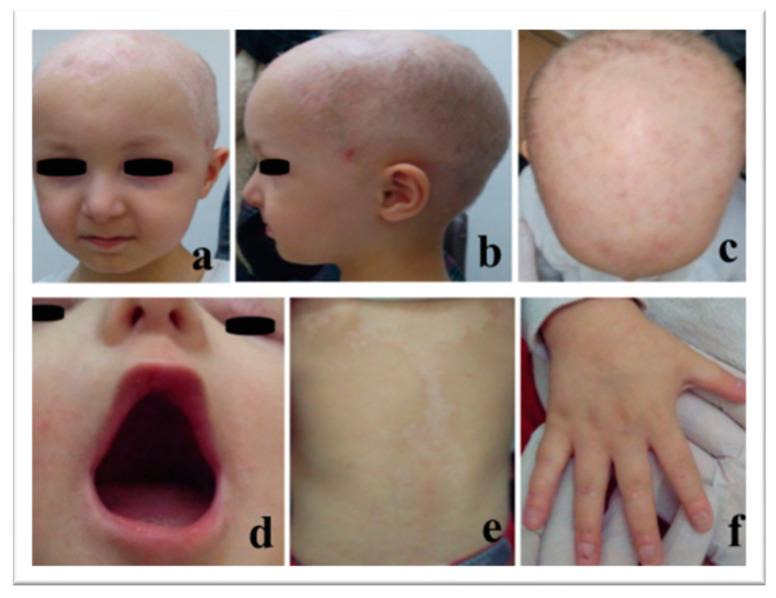 https://cdn.ncbi.nlm.nih.gov/pmc/blobs/7ba2/10298433/600beb0bbc69/genes-14-01246-g001.jpg