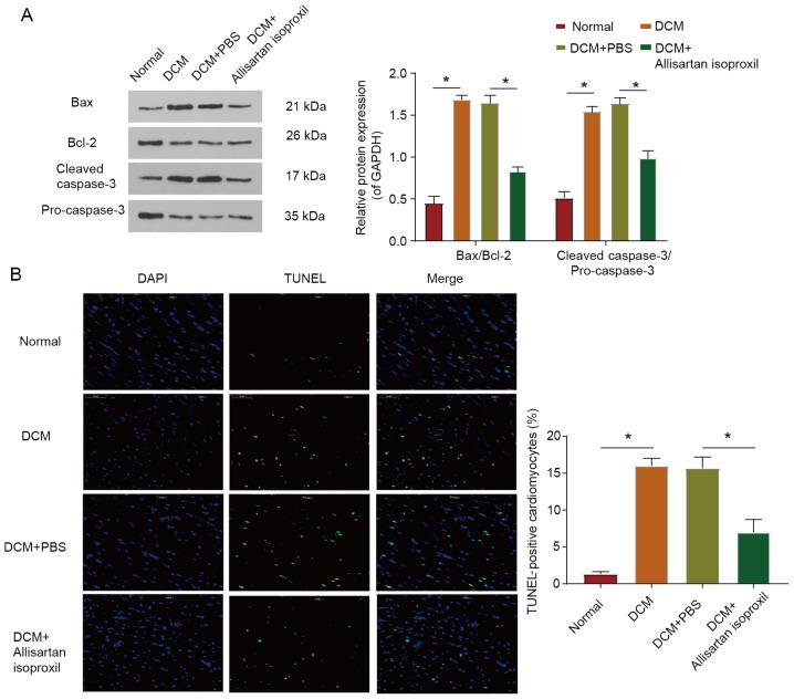 https://cdn.ncbi.nlm.nih.gov/pmc/blobs/7ba2/7845586/1a22161641a5/mmr-23-03-11854-g04.jpg