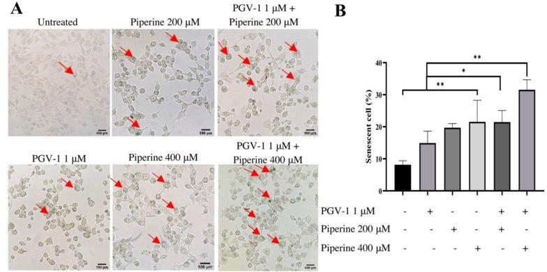 https://cdn.ncbi.nlm.nih.gov/pmc/blobs/7ba2/9191230/b876a732b530/ijpr-21-1-123820-i003.jpg