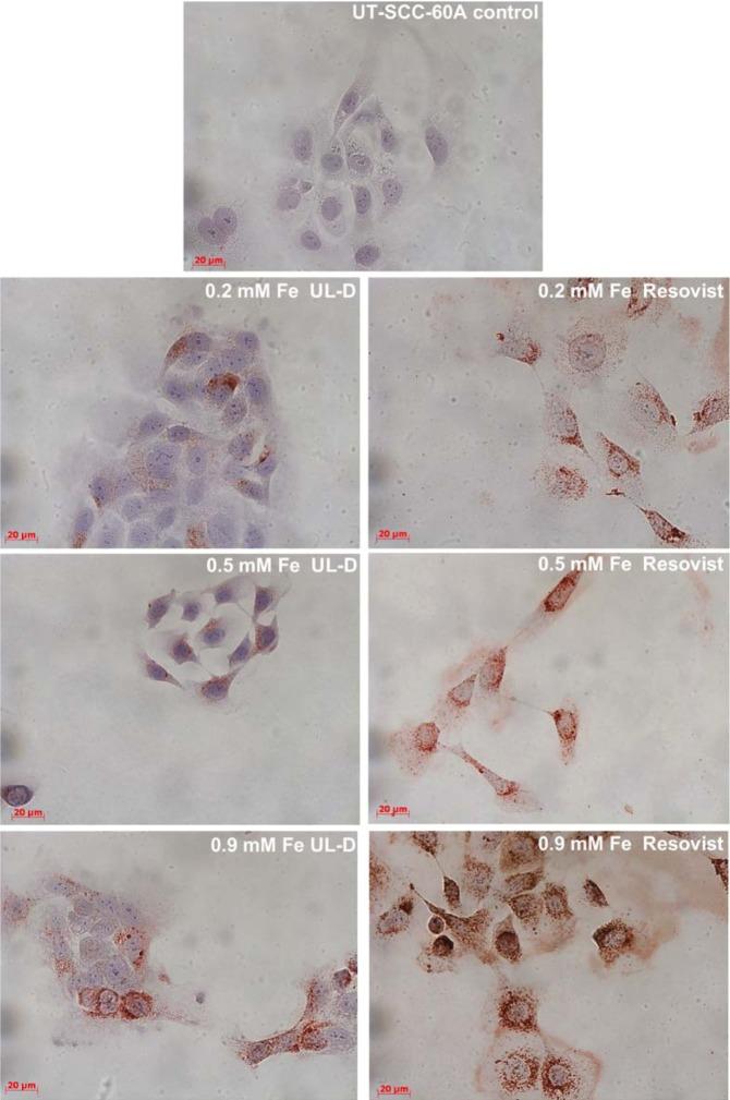 https://cdn.ncbi.nlm.nih.gov/pmc/blobs/7ba3/4218924/c26a9f4f7bc3/ijn-9-5025Fig9.jpg
