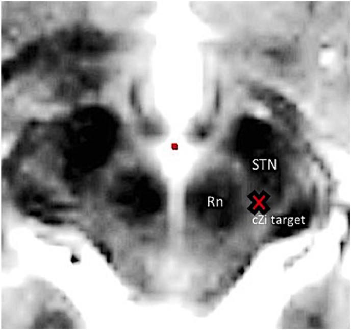 https://cdn.ncbi.nlm.nih.gov/pmc/blobs/7ba4/12172708/10d536595999/gr1.jpg