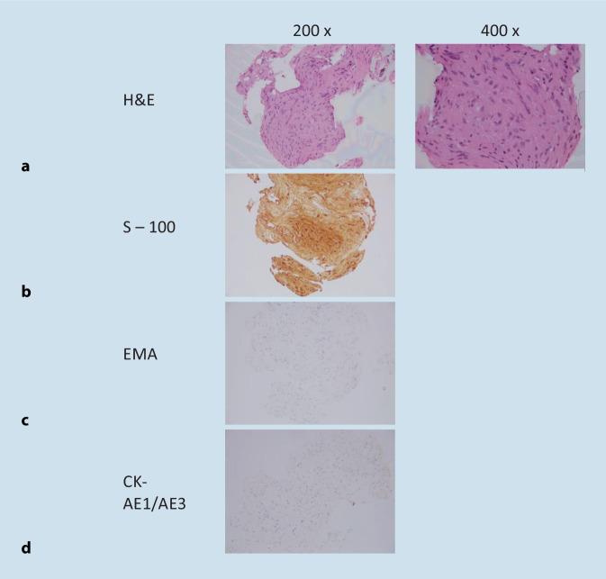 https://cdn.ncbi.nlm.nih.gov/pmc/blobs/7ba5/10663204/2496207186ce/106_2023_1379_Fig5_HTML.jpg