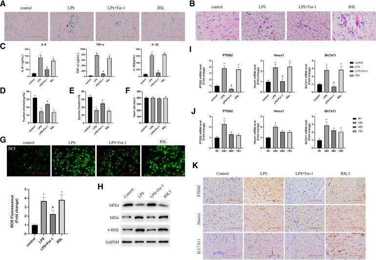 https://cdn.ncbi.nlm.nih.gov/pmc/blobs/7ba7/10326630/e223de7e34d3/fcvm-10-1185924-g006.jpg