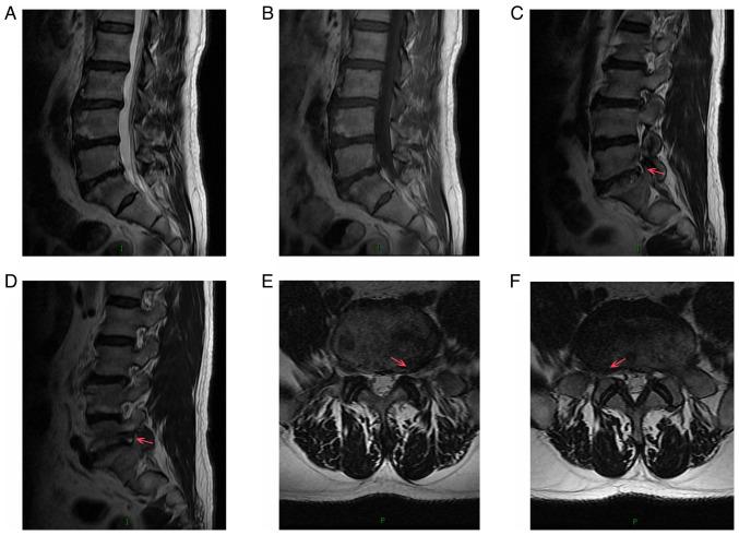 https://cdn.ncbi.nlm.nih.gov/pmc/blobs/7ba8/10792407/b727f4575098/etm-27-02-12354-g02.jpg
