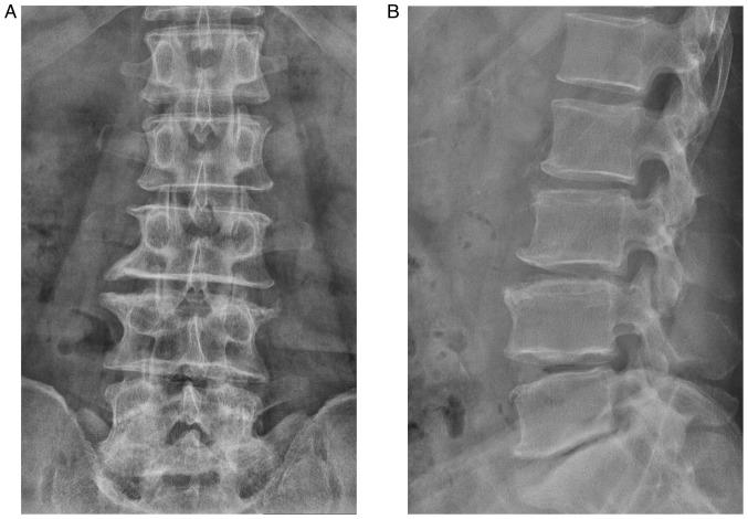 https://cdn.ncbi.nlm.nih.gov/pmc/blobs/7ba8/10792407/ef76c7c90e78/etm-27-02-12354-g01.jpg