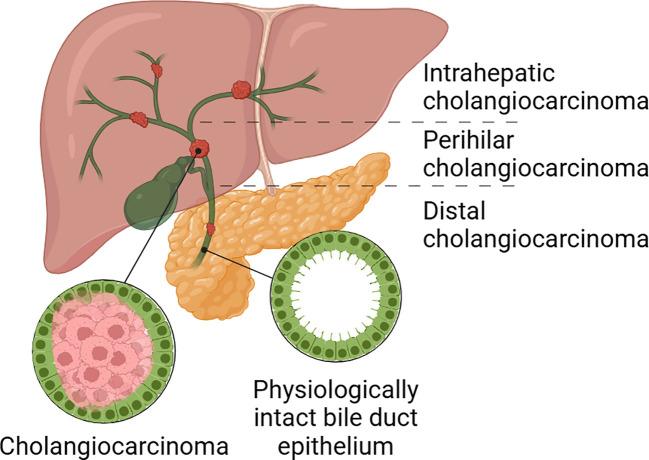 https://cdn.ncbi.nlm.nih.gov/pmc/blobs/7baa/12350147/4a6187232291/fonc-15-1598552-g001.jpg