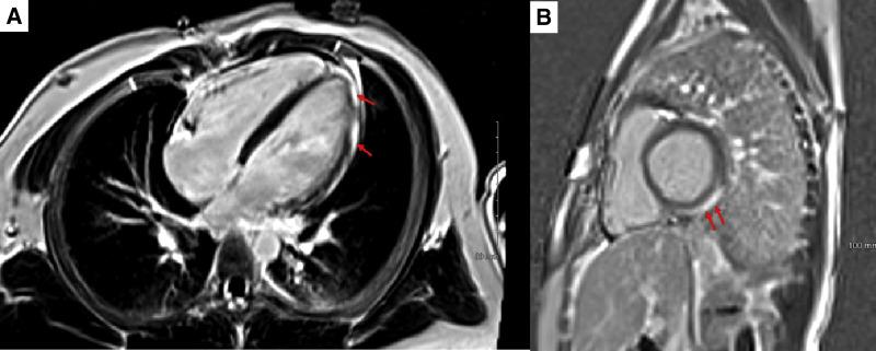 https://cdn.ncbi.nlm.nih.gov/pmc/blobs/7baa/8321962/a0297a6fe7e9/gr2_lrg.jpg