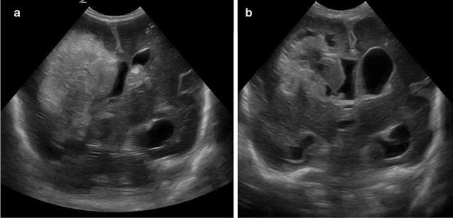 https://cdn.ncbi.nlm.nih.gov/pmc/blobs/7bac/5870202/7a246e5d8bbd/12987_2018_96_Fig1_HTML.jpg