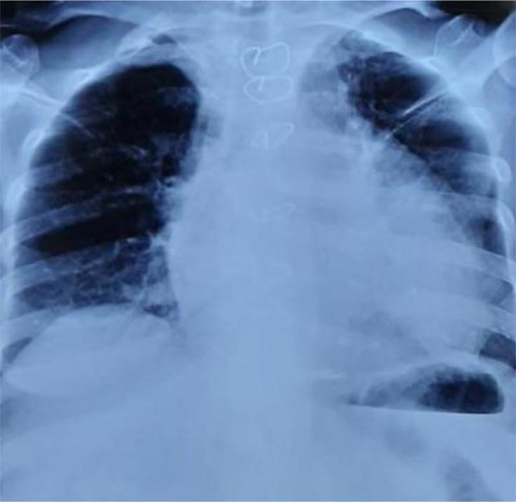https://cdn.ncbi.nlm.nih.gov/pmc/blobs/7bb3/12048714/ca0c0d29a9ac/acmi-7-00983-g001.jpg