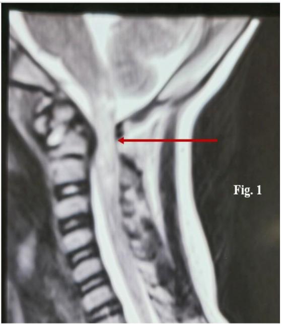 https://cdn.ncbi.nlm.nih.gov/pmc/blobs/7bbe/11770658/f069248f4af4/nmj-65-1194-f1.jpg