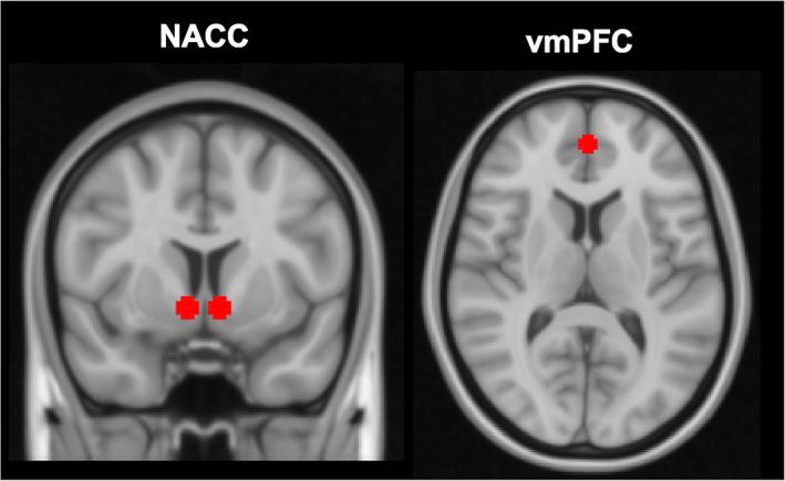 https://cdn.ncbi.nlm.nih.gov/pmc/blobs/7bc6/10258536/a8045127b3cf/HBM-44-3972-g002.jpg