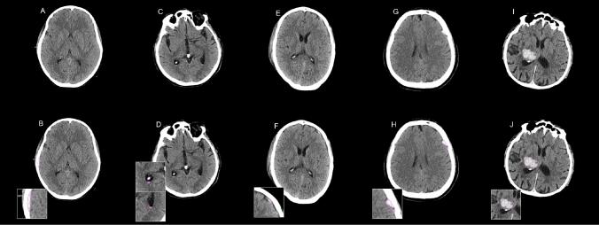 https://cdn.ncbi.nlm.nih.gov/pmc/blobs/7bc6/11480174/0f0a2ef5f723/11547_2024_1867_Fig2_HTML.jpg