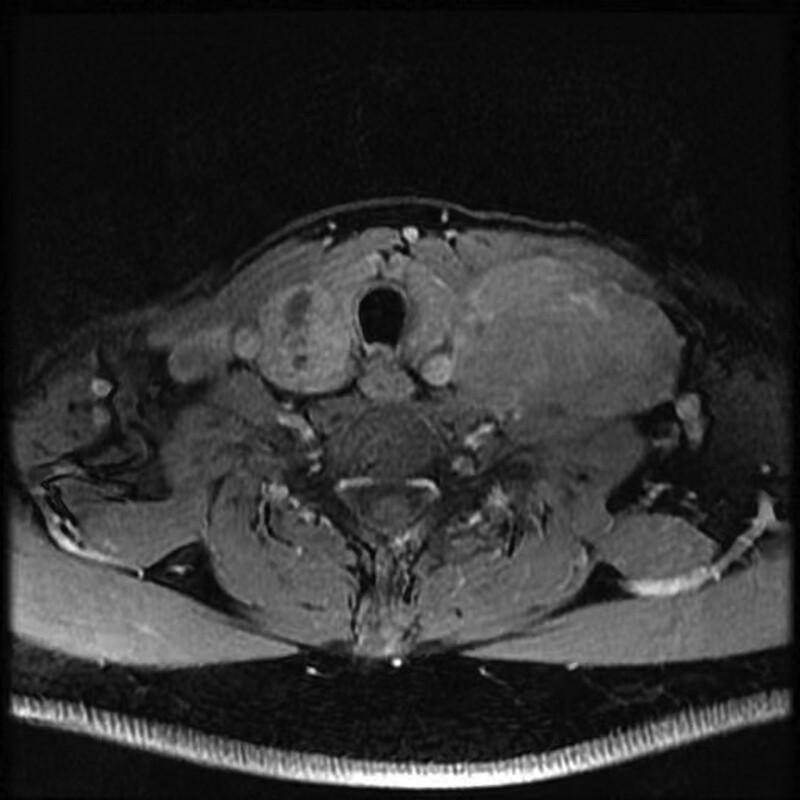 https://cdn.ncbi.nlm.nih.gov/pmc/blobs/7bc7/10662830/d998ac9eb242/medi-102-e34350-g001.jpg