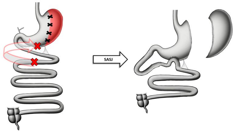 https://cdn.ncbi.nlm.nih.gov/pmc/blobs/7bcb/11396194/b65bcd82576b/jcm-13-05279-g005.jpg
