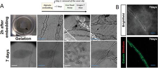 https://cdn.ncbi.nlm.nih.gov/pmc/blobs/7bcc/11468676/158430141109/ADHM-13-2302830-g004.jpg