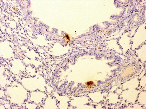 https://cdn.ncbi.nlm.nih.gov/pmc/blobs/7bcd/3352129/779f889e7e74/ejh-2012-1-e10-g005.jpg