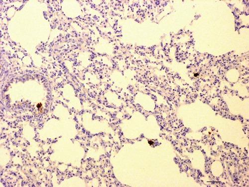 https://cdn.ncbi.nlm.nih.gov/pmc/blobs/7bcd/3352129/bc0dd66c942b/ejh-2012-1-e10-g002.jpg