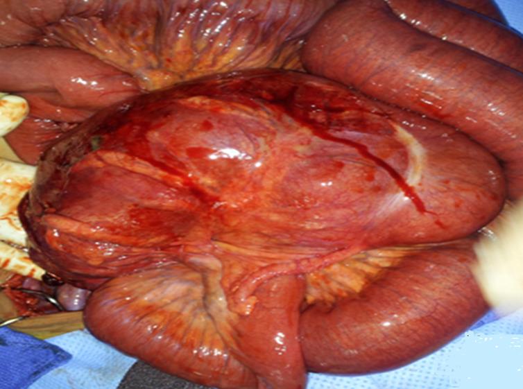 https://cdn.ncbi.nlm.nih.gov/pmc/blobs/7bd1/7881923/d4580b1d3bc0/PAMJ-37-287-g005.jpg