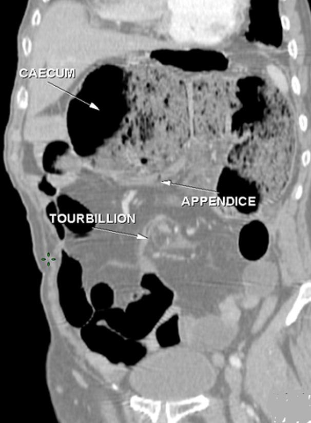 https://cdn.ncbi.nlm.nih.gov/pmc/blobs/7bd1/7881923/dbfd28281e50/PAMJ-37-287-g003.jpg
