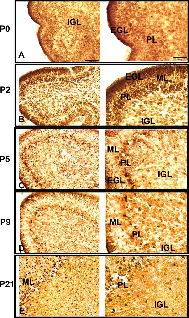 https://cdn.ncbi.nlm.nih.gov/pmc/blobs/7bd2/8174006/106dc2d2400f/ENEURO.0011-21.2021_f004.jpg