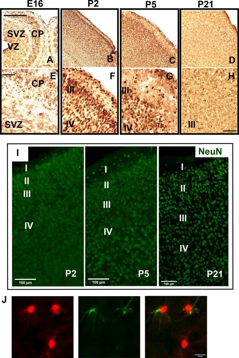 https://cdn.ncbi.nlm.nih.gov/pmc/blobs/7bd2/8174006/4714e30639cc/ENEURO.0011-21.2021_f003.jpg