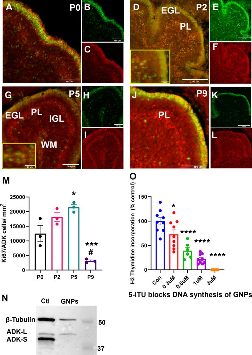 https://cdn.ncbi.nlm.nih.gov/pmc/blobs/7bd2/8174006/6544a7d525ba/ENEURO.0011-21.2021_f005.jpg