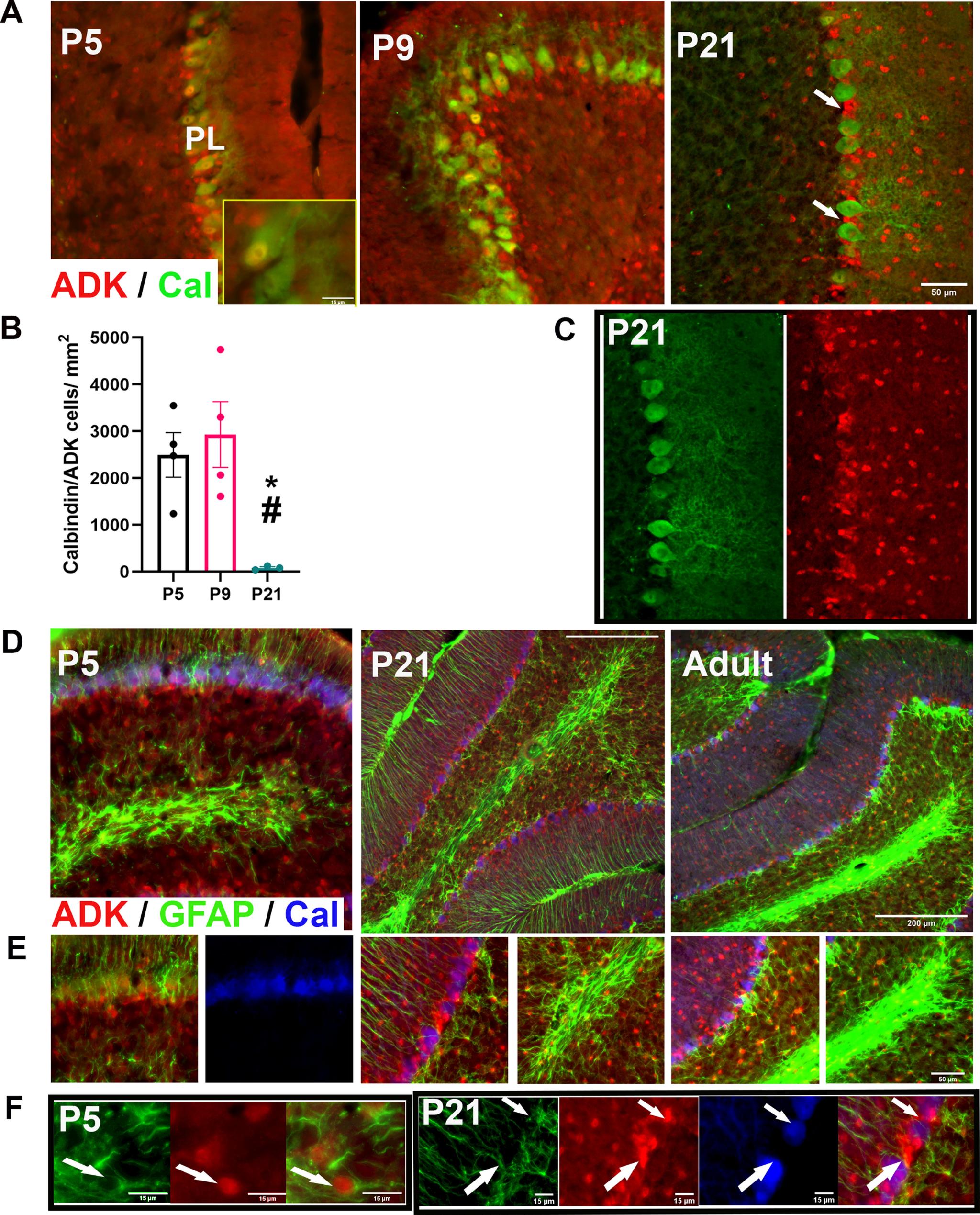 https://cdn.ncbi.nlm.nih.gov/pmc/blobs/7bd2/8174006/7e1cffc150f3/ENEURO.0011-21.2021_f006.jpg