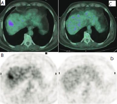 https://cdn.ncbi.nlm.nih.gov/pmc/blobs/7bd4/3178485/4a9f1d07c103/1477-7819-9-86-4.jpg