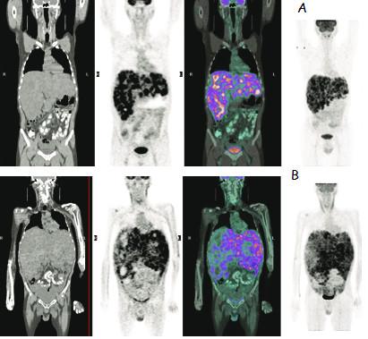 https://cdn.ncbi.nlm.nih.gov/pmc/blobs/7bd4/3178485/bde4d91ed12c/1477-7819-9-86-5.jpg