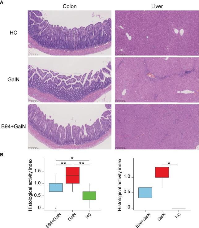 https://cdn.ncbi.nlm.nih.gov/pmc/blobs/7be1/9277360/989c584b6336/fcimb-12-914684-g002.jpg