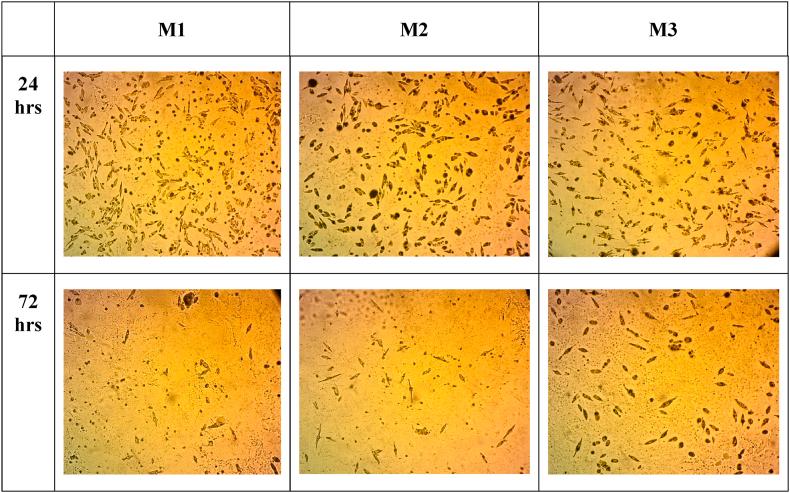 https://cdn.ncbi.nlm.nih.gov/pmc/blobs/7be6/10598492/7b1bce63dd79/gr3.jpg