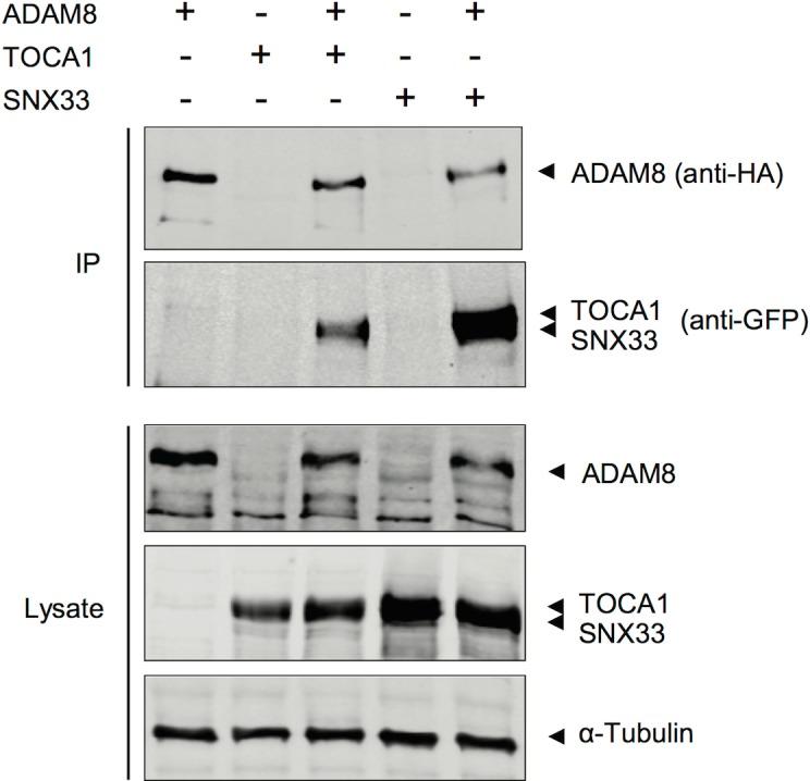 https://cdn.ncbi.nlm.nih.gov/pmc/blobs/7be7/4380453/41a6ff10d851/pone.0121301.g004.jpg