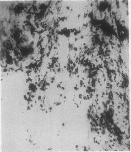 https://cdn.ncbi.nlm.nih.gov/pmc/blobs/7be7/480554/8c77b698d65f/jclinpath00074-0070-a.jpg